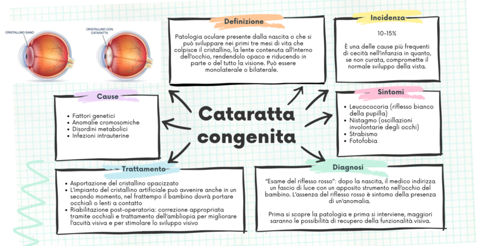 L'immagine mostra un'infografica sulla cataratta congenita con informazioni relative a definizione, incidenza, sintomi, cause, diagnosi e trattamento, illustrate tramite grafici e blocchi di testo.